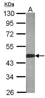 Polyclonal Rabbit anti-Human BCAT2 Antibody (aa1-332, IHC, WB)