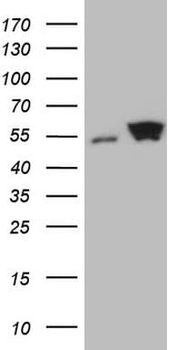 SHMT / SHMT2 Antibody (clone OTI3E9)