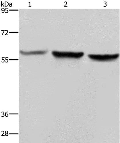 Polyclonal Rabbit anti-Human SYN2 / Synapsin II Antibody (IHC, WB)