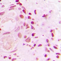 Polyclonal Rabbit anti-Human TP53BP1 / 53BP1 Antibody (N-Terminus, IHC, IF, WB)