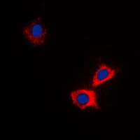 IHC-plus™ Polyclonal Rabbit anti-Human ABCB10 Antibody (Internal, IHC, IF, WB)