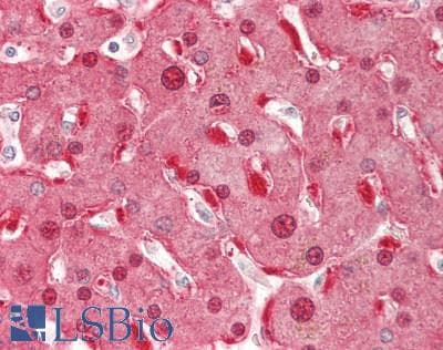 IHC-plus™ NNMT Antibody (clone 2A3)