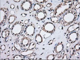 TS / Thromboxane Synthase Antibody (clone OTI1B8)
