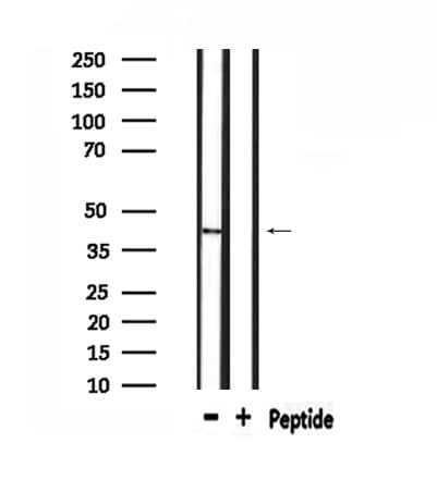 Polyclonal Rabbit anti-Human MPRG / PAQR5 Antibody (IF, WB)