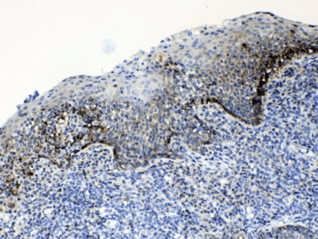 ALCAM / CD166 Antibody