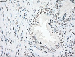 PLK1 / PLK-1 Antibody (clone OTI6C6)