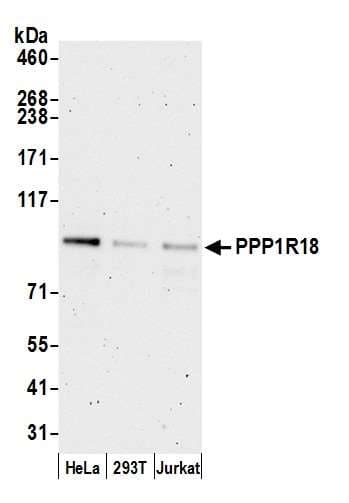 PPP1R18 Antibody (aa375-425)