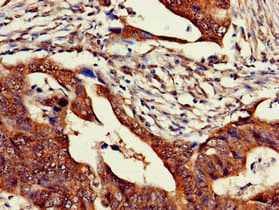 Polyclonal Rabbit anti-Human ZNF816 / ZNF816A Antibody (IHC, IF)
