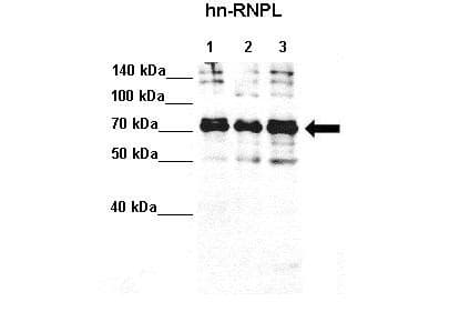 Polyclonal Rabbit anti-Human HNRNPL / hnRNP L Antibody (aa82-131, IHC, WB)