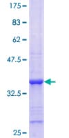 Human SLA Protein (Recombinant GST, N-terminus)