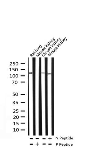 BCAR1 / p130Cas Antibody (phospho-Tyr410)