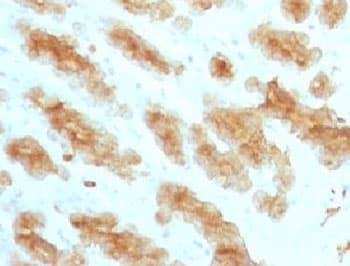 Acidic Cytokeratin Antibody (clone KRTL/1077)