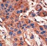 Polyclonal Rabbit anti-Human ALK3 / BMPR1A Antibody (aa30-60, IHC, WB)