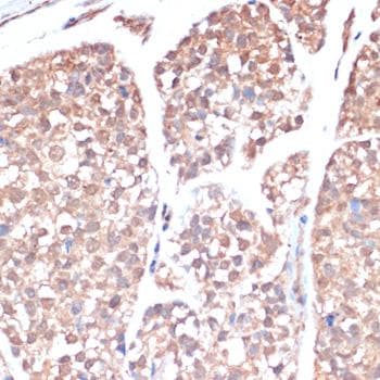 PRMT7 Antibody