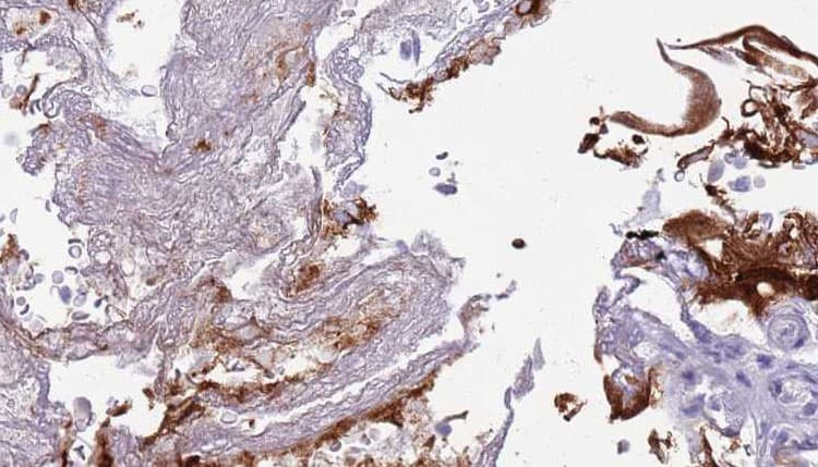 CD27 Antibody