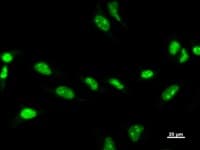 ZSCAN21 / Zipro1 Antibody (clone 3418F1a)