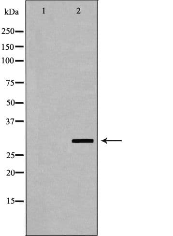 FCGR3A / CD16A Antibody