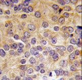PRMT3 Antibody (aa142-173)