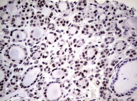 NBN / Nibrin Antibody (clone OTI6E11)