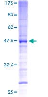 Human PMP70 Protein (Recombinant GST)