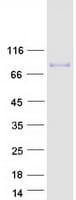 Human COL9A3 / Collagen IX Protein (Recombinant Myc-DDK (Flag))