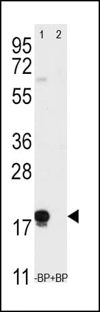 IHC-plus™ Polyclonal Rabbit anti-Human THY1 / CD90 Antibody (aa36-65, IHC, WB)
