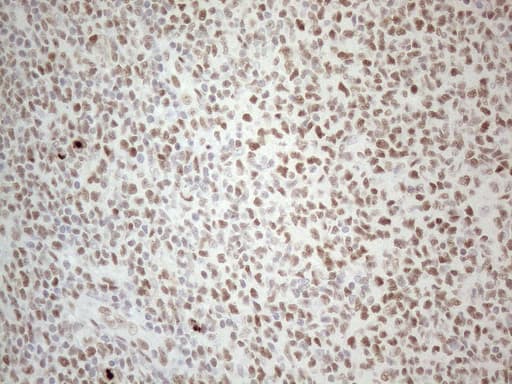 TP53BP1 / 53BP1 Antibody (aa1-300, clone OTI5E1)