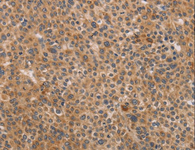 Polyclonal Rabbit anti-Human CDK11B / CDC2L1 Antibody (IHC, WB)