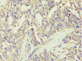 BCKDK Antibody (aa153-412)