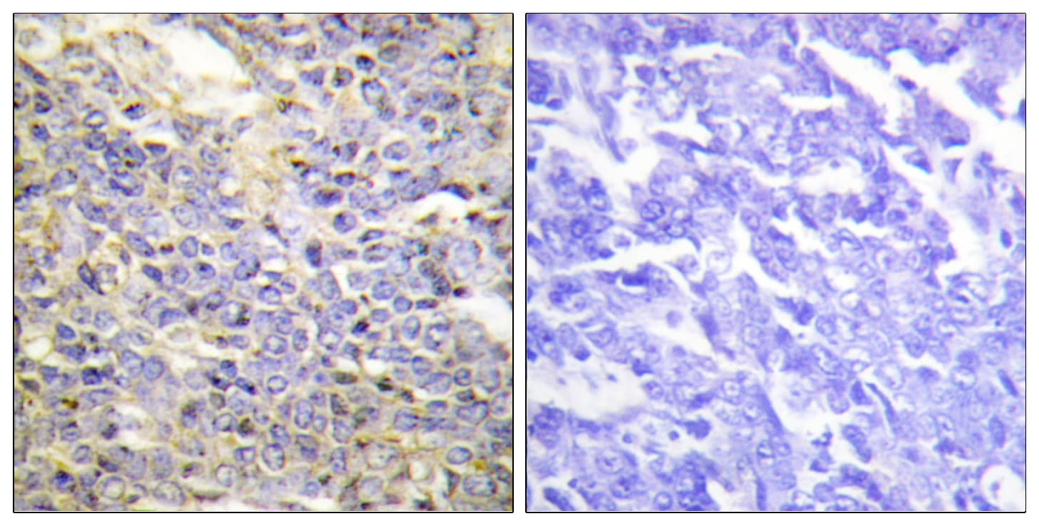 Polyclonal Rabbit anti-Human CASP9 / Caspase 9 Antibody (aa91-140, IHC, IF, WB)
