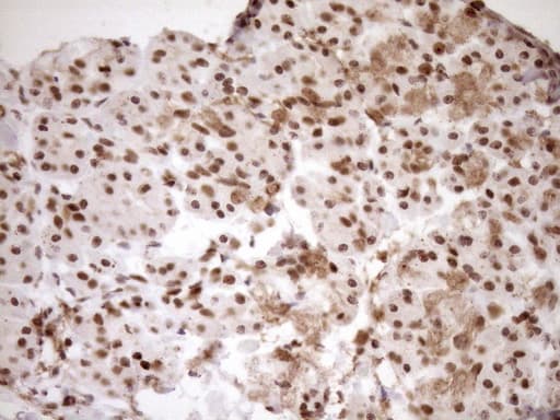 EXOSC1 / CSL4 Antibody (clone OTI1H9)