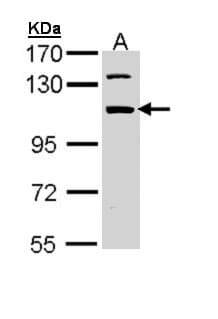 RBM28 Antibody (aa475-745)