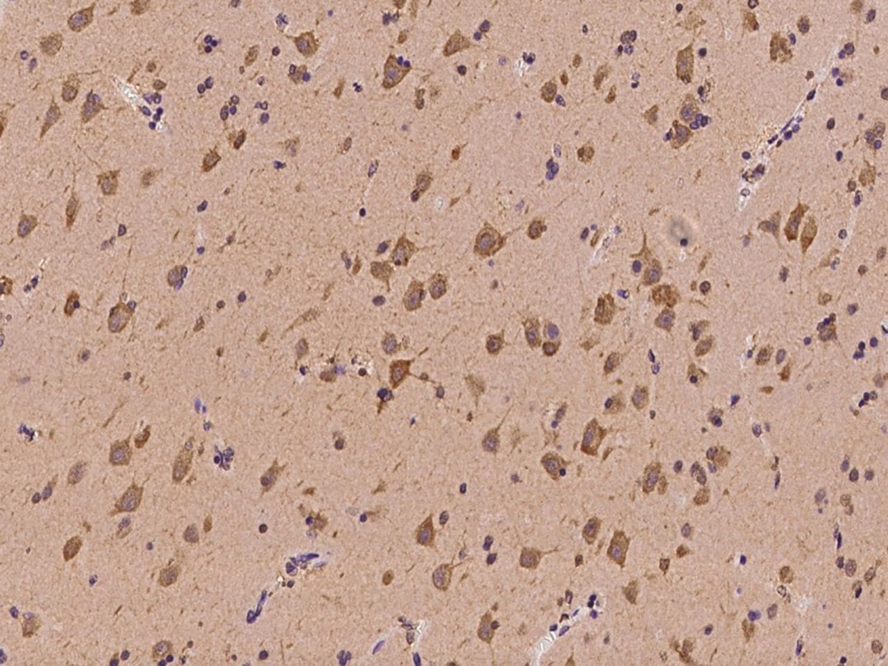 YARS / Tyrosyl-tRNA Synthetase Antibody