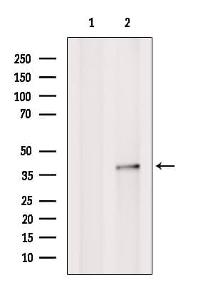 Polyclonal Rabbit anti-Human SCO2 Antibody (WB)