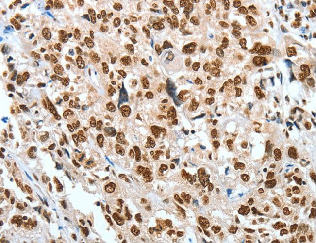 BNIP1 Antibody