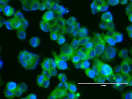 ERBB2 / HER2 Antibody (aa676-1255, clone UMAB35)