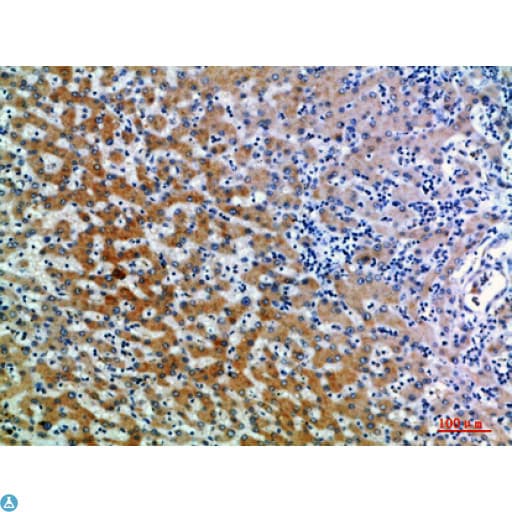 Polyclonal Rabbit anti-Human CD109 Antibody (IHC)