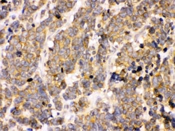 PDPK1 / PDK1 Antibody