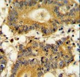 Polyclonal Rabbit anti-Human RPS6KA1 / RSK1 Antibody (IHC, WB)
