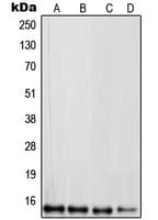 RPL30 / Ribosomal Protein L30 Antibody (C-Terminus)