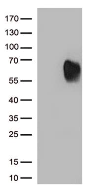 MAdCAM-1 Antibody (clone UMAB158)