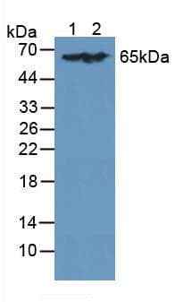 LCP1 / L-Plastin Antibody (aa5-233)