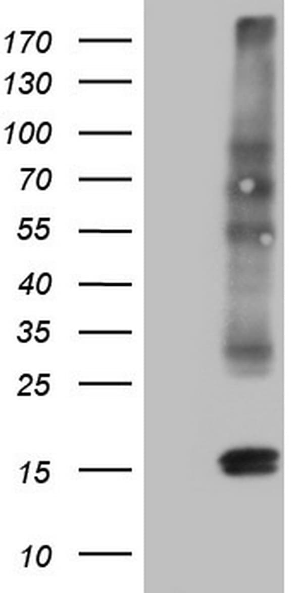 CGB / hCG Beta Antibody (aa21-165, clone OTI12H5)