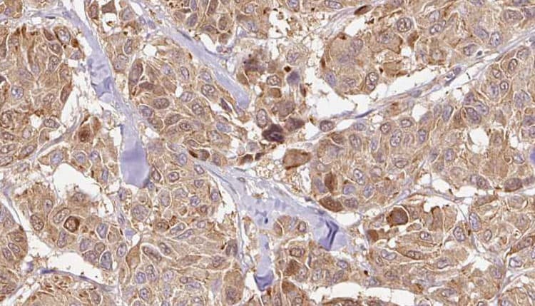 NTF4 / Neurotrophin 4 Antibody