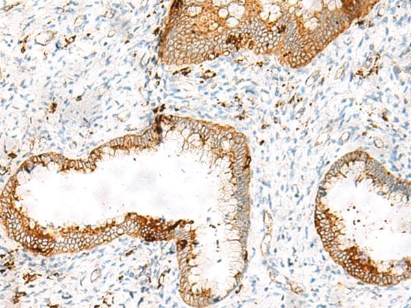 HLA-DRB1 Antibody