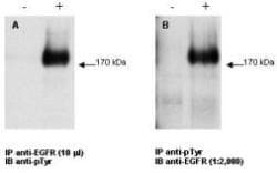 IHC-plus™ EGFR Antibody