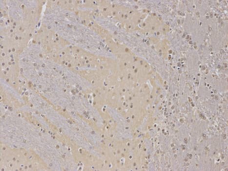 PPP2R2A Antibody
