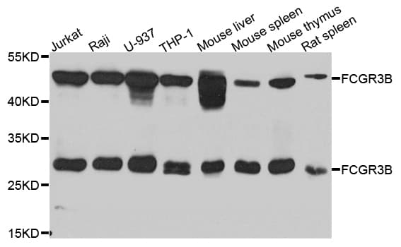 Polyclonal Rabbit anti-Human FCGR3B / CD16B Antibody (WB)