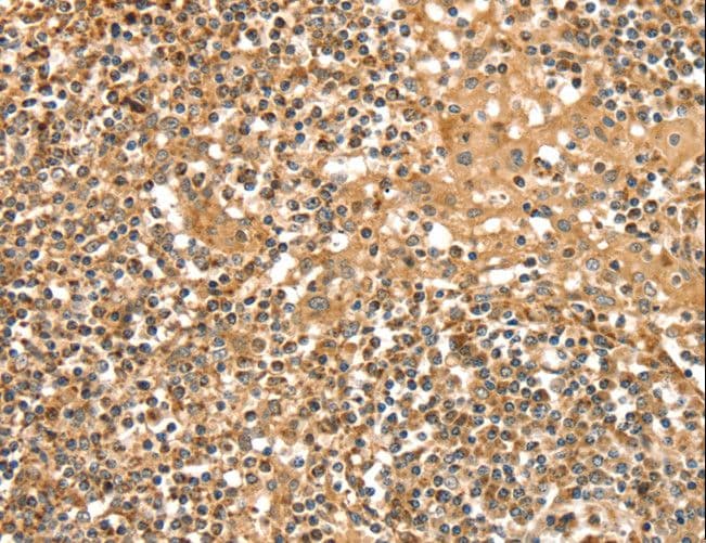 IHC-plus™ SLC8A3 / NCX3 Antibody