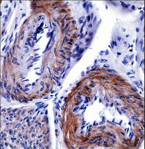 Polyclonal Rabbit anti-Human ZRP-1 / TRIP6 Antibody (aa95-124, IHC, WB)